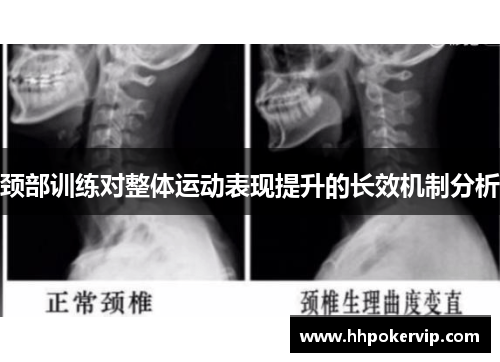 颈部训练对整体运动表现提升的长效机制分析